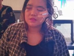 Korban KDRT di Kota Agung timur Resmi Laporkan Suaminya ke pihak berwajib