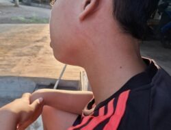 Ditampar Hingga Memar, Keluarga Siswa Yayasan Al Hasani Kecam Lemahnya Sanksi Oknum Guru